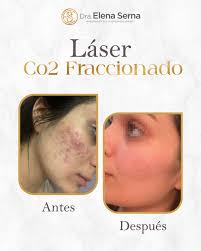 Dra.Elena Serna (@dra.elenaserna) • Instagram photos and videos