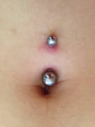Buy Infected Belly Button Piercing Treatment Off 51