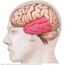 What happens to your brain when you have a seizure. Epilepsy Surgery Mayo Clinic