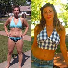 Charlene Andersen Has Been On A Fully Carnivorous Diet For Over 20 Years The Picture On The Left Was Taken In Her Mid Twenties Diet Gm Diet Low Protein Diet Shawn baker is an american former orthopedic surgeon, bodybuilder, carnivore diet advocate, cholesterol denialist, pseudoscience promoter and internet troll. charlene andersen has been on a fully