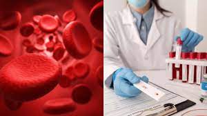 50 Year Old Mystery Solved As Scientists Discover New Blood Group System -  Science