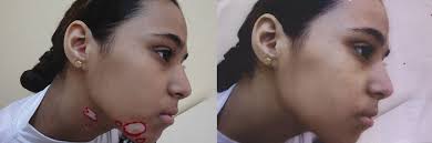 NASZA DERMATOLOGIAOnline OUR DERMATOLOGYOnline