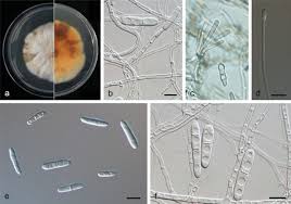 Image result for Dacryotrichia