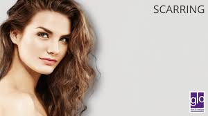 Scar Treatments For Smoother Skin at Glo Skin & Medspa in Edmonton