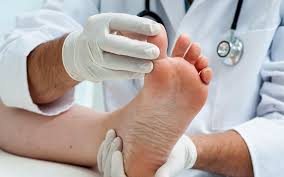 Image result for diabetic toes