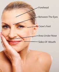 How much is botox around the eyes? How Much Does Botox Cost Our Price Estimating Guide For Common Areas Treated By Botox Altura Aesthetics Botox Cost Botox Forehead Botox Lips