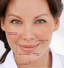 Remove Fine Lines And Get Smooth Skin Together With Juvederm The Filler Injections Provided By Our Professiona Nasolabial Folds How To Line Lips Chin Wrinkles