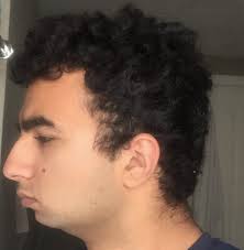 Can I Get A Better Jawline Through Weight Loss Teenagers