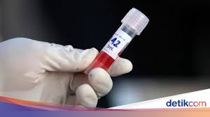 Berapa Lama Tes Swab Covid 19 Bisa Diketahui Hasilnya Ini Kata Pakarnya