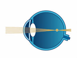 We did not find results for: Fehlsichtigkeiten Und Augenlaserbehandlungen Augeauge De