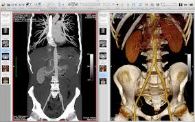Our software can be used to convert jpeg, bmp images to dicom images. Open View And Read Dicom Dcm Medical Images In Mac Os X Ios With Osirix Osxdaily