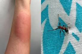Image result for ant bite