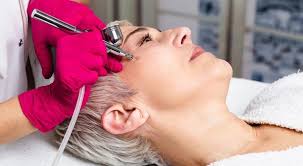 Alma TED Hair Restoration