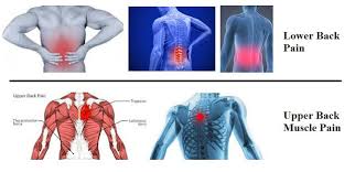 Pin Di All About Back Pain