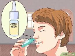 Have nasal polyps and looking for the right south florida ent doctor to help you treat. 3 Ways To Cure Nasal Polyps Wikihow