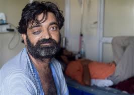 Black white and yellow fungus pictures. Black White And Yellow Fungus Infected Patient Receives Treatment At Hospital Photos Hd Images Pictures News Pics Oneindia Photos