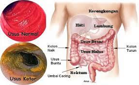 4 tanda usus anda kotor, dan bagaimana cara membersihkannya. 4 Tanda Berikut Menunjukkan Usus Anda Mulai Kotor