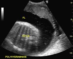 We did not find results for: A Gallery Of High Resolution Ultrasound Color Doppler 3d Images Amniotic Fluid