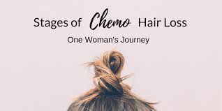Whether you want wigs to look younger,wigs for hair loss, wigs for thinning hair, or wigs for cancer patients you will find that our wash and wear wigs are high quality and so realistic looking! The Many Phases Of Chemo Hair Loss There Is Grace