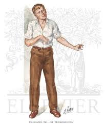 Image result for Chorea