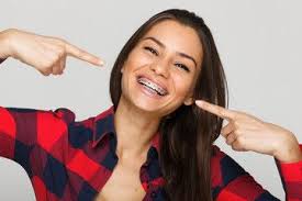 Face Of A Young Woman With Braces On Her Teeth Brackets Dentales Dentistas Ortodoncia