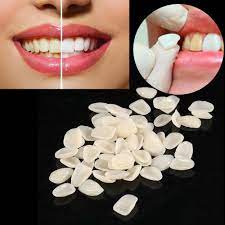 Ces Couronnes Dentaires Sont Utilisees Pour Empecher La Stimulation De Vos Dents Apres Des Dents En Porcelaine Ou En O Veneers Teeth Teeth Dentist Dental Teeth