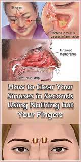 How To Clear Your Sinuses In Seconds Using Nothing But Your Fingers Best Women Tips Sinus Remedies Sinusitis Sinus Blockage