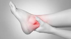 Tips pengobatan sakit pergelangan tangan dan kaki karena bengkak dengan obat sakit pergelangan dari teripang emas yang sudah terbukti mampu mengobati sakit pergelangan di bagian tangan dan kaki secara alami tanpa adanya efek samping dan ketergantungan. Penyakit Pergelangan Kaki Terkilir Gejala Penyebab Pengobatan Klikdokter Com