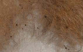 Believe it or not, one of the most common reasons for black specks in your stools is the foods you have been eating! Differences Between Flea Eggs And Dandruff Fleascience