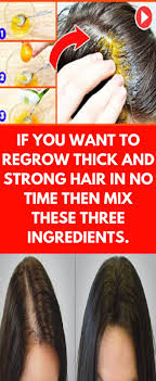 Biotin Hair Growth Results Before And After If You Want To Regrow Thick And Strong Hair In No Time Then Mix These Three Ingredients Strong Hair Vitamins For Hair Growth Hair Growth Conditioner