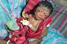 Check spelling or type a new query. Bayi Baru Lahir Ini Terlihat Seperti Berusia 80 Tahun