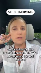 Sharing this video from @alexisparcellsmd who is fighting a denial for  breast reconstruction. , The case is clear: her reconstruction needs to  happen before radiation, or she’ll lose her chance for ...
