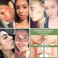 Image result for Grevea