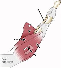 Longus, long) is a muscle in the forearm and hand that flexes the thumb. High Resolution Mr Imaging And Us Anatomy Of The Thumb Radiographics