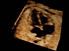 Wie lief das organscreening ab, bei denen, die schon kinder haben? Zentrum Fur Pranataldiagnostik Und Humangenetik Kudamm 199