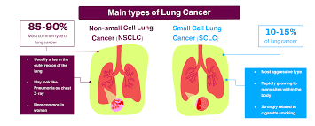 Small cell lung cancers are responsible for around 15 percent of lung cancers in the united states. Team Ibowu China Description 2020 Igem Org