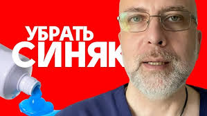 как быстро убрать синяк под глазом от удара и опухоль Sinyaki I Ushiby Kak Bystro Ubrat Gematomu I Chem Polezny Medicinskie Banki Youtube