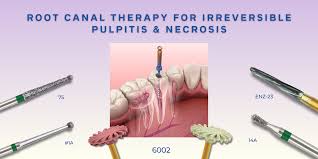 Image result for Pulpitis