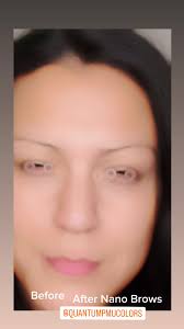 ✨ Xeomin vs. Botox vs. Dysport: Which is Right for You? ✨ ASK FOR OUR  SPECIALS In Austin, we're all about looking our best! But which neurotoxin  should you choose for smoother