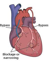 Pin By Paul Matlin On Science That Is Sweet Cardiology Cardiac Nursing Surgery
