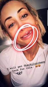 Pro Wrestling Spotlight - Carmella Got A Busted Lip From Becky. Jjl |  Facebook