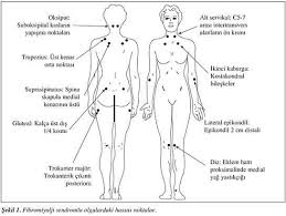 Tüm vücutta yaygın ağrı ile seyreden bir hastalık olan fibromiyalji'de tedavinin en önemli kısmı düzenli egzersiz yapmaktır. Fibromiyalji Boyun Agrisi Belirtileri Ve Tedavisi Fibromiyalji Gen Tr