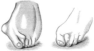 In this case the feet will yet again be flat along the ground. File Psm V24 D668 Female Feet Deformed By High Heel Narrow Small Shoes Jpg Wikimedia Commons