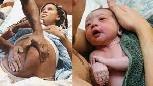 Maybe you would like to learn more about one of these? Doctor Turns Breech Baby Still In Mother S Belly Youtube