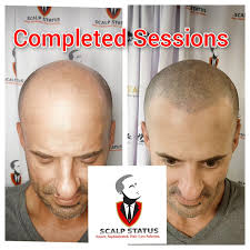 Scalp Status