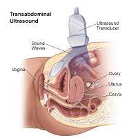 To evaluate female reproductive organs in pediatric patients or those that are not sexually active or. Pelvic Ultrasound Johns Hopkins Medicine