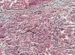 Reticular fibers are not unique to reticular connective tissue, but only in this type they are dominant. Reticular Connective Tissue 20x Histology