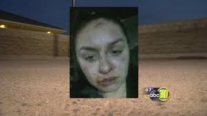 Domestic abuse victim speaks out