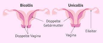 Dippelte vagina