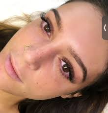 Fox Hollow Esthetics